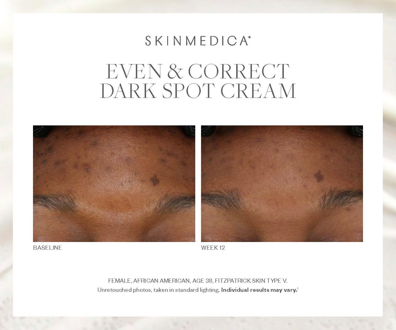 SkinMedica SkinMedica Even & Correct Dark Spot Cream – skinfo